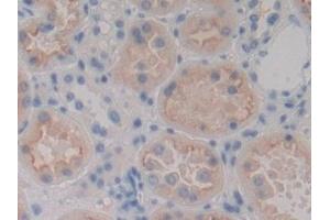 Detection of MASP1 in Human Kidney Tissue using Polyclonal Antibody to Mannose Associated Serine Protease 1 (MASP1)
