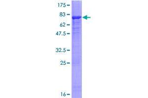 Image no. 1 for Pleckstrin Homology Domain Containing, Family M (With RUN Domain) Member 2 (PLEKHM2) (AA 1-440) protein (GST tag) (ABIN1315412)