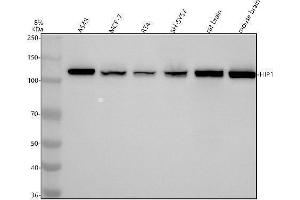 Western blot analysis of HIP1 using anti-HIP1 antibody (ABIN7604060).