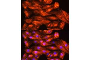 Immunofluorescence analysis of H9C2 cells using ZCCHC11 Rabbit pAb (ABIN6128939, ABIN6150406, ABIN6150407 and ABIN6221650) at dilution of 1:100. (ZCCHC11 anticorps  (AA 1-290))