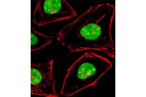 Immunofluorescent analysis of 4 % paraformaldehyde-fixed, 0.