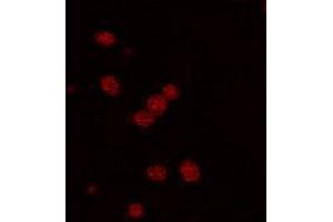 Immunofluorescence staining of PDE2A expressing cell with PDE2A polyclonal antibody . (PDE2A anticorps  (C-Term))
