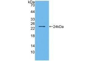 Detection of Recombinant BMF, Human using Polyclonal Antibody to Bcl2 Modifying Factor (BMF)