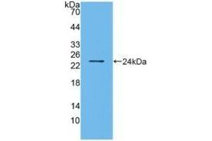 Detection of Recombinant BMF, Human using Polyclonal Antibody to Bcl2 Modifying Factor (BMF) (BMF anticorps  (AA 1-181))