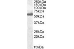 Image no. 1 for anti-Interferon Regulatory Factor 5 (IRF5) (C-Term) antibody (ABIN374255) (IRF5 anticorps  (C-Term))
