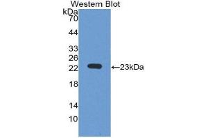 IGLL1 Antikörper  (AA 29-201)