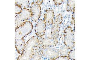 Immunohistochemistry of paraffin-embedded mouse kidney using SLC22/OCT3 Rabbit mAb (ABIN7269107) at dilution of 1:100 (40x lens). (SLC22A3 anticorps)