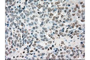 Image no. 2 for anti-Checkpoint Kinase 2 (CHEK2) antibody (ABIN1497498) (CHEK2 anticorps)