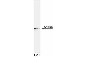 Western blot analysis of Cytokeratin 7. (Cytokeratin 7 anticorps)