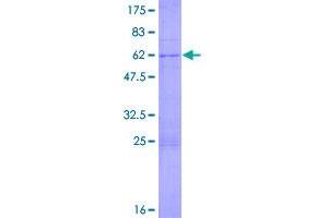 Image no. 1 for Mitochondrial Translational Initiation Factor 3 (MTIF3) (AA 1-278) protein (GST tag) (ABIN1311566)