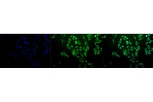 Immunocytochemistry/Immunofluorescence analysis using Rabbit Anti-Ubiquitin Polyclonal Antibody (ABIN361830 and ABIN361831). (Ubiquitin anticorps)