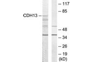 Western blot analysis of extracts from LOVO cells, using CDH13 Antibody. (Cadherin 13 anticorps  (AA 331-380))