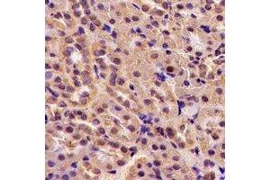 Immunohistochemical analysis of TGase5 staining in rat kidney formalin fixed paraffin embedded tissue section. (Transglutaminase 5 anticorps)