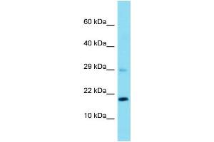 Host: Rabbit  Target Name: Rps23  Sample Tissue: Rat Liver lysates  Antibody Dilution: 1. (RPS23 anticorps  (N-Term))