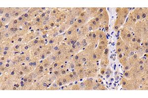 Detection of NRP1 in Human Liver Tissue using Monoclonal Antibody to Neuropilin 1 (NRP1)