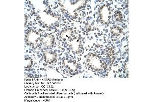 Rabbit Anti-HNRPAB Antibody  Paraffin Embedded Tissue: Human Lung Cellular Data: Alveolar cells Antibody Concentration: 4. (HNRNPAB anticorps  (C-Term))