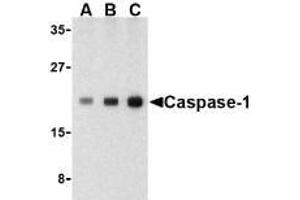Western blot analysis of Caspase-1 in human heart cell lysate with AP30187PU-N Caspase-1 antibody at (A) 0. (Caspase 1 anticorps  (C-Term))