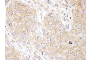 Immunohistochemistry (IHC) image for anti-Dynactin 2 (p50) (DCTN2) (AA 351-401) antibody (ABIN7453628)
