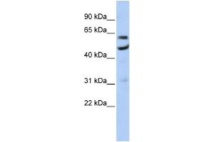 WB Suggested Anti-CNOT6 Antibody Titration:  0. (CNOT6 anticorps  (N-Term))