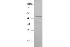 Western Blotting (WB) image for Fucosyltransferase 8 (Alpha (1,6) Fucosyltransferase) (FUT8) (AA 31-256) protein (His-IF2DI Tag) (ABIN7123015)