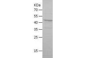 Western Blotting (WB) image for Fucosyltransferase 8 (Alpha (1,6) Fucosyltransferase) (FUT8) (AA 31-256) protein (His-IF2DI Tag) (ABIN7283888) (FUT8 Protein (AA 31-256) (His-IF2DI Tag))