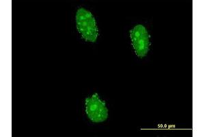 Immunofluorescence of monoclonal antibody to UHRF2 on HeLa cell. (UHRF2 anticorps  (AA 81-180))