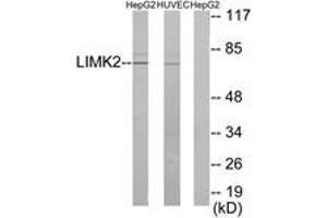 Western blot analysis of extracts from HepG2/HuvEc cells, using LIMK2 Antibody. (LIMK2 anticorps  (AA 461-510))