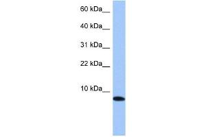 TNP1 antibody used at 1 ug/ml to detect target protein. (TNP1 anticorps)