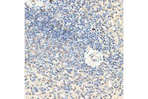 Immunohistochemistry of paraffin-embedded human spleen using CD70 Rabbit pAb (ABIN3022742, ABIN3022743, ABIN3022744, ABIN1512720 and ABIN6219205) at dilution of 1:100 (40x lens).