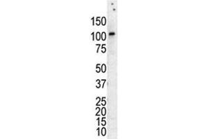 Western blot analysis of PKC nu antibody in lysate of HL-60 cells stimulated with PMA.