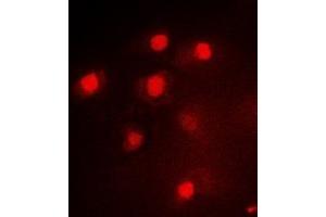 Immunofluorescent analysis of PAX3 staining in Hela cells. (Paired Box 3 anticorps)