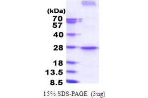 SDS-PAGE (SDS) image for Programmed Cell Death 1 Ligand 2 (PDCD1LG2) (AA 20-200) protein (His tag) (ABIN5853804)