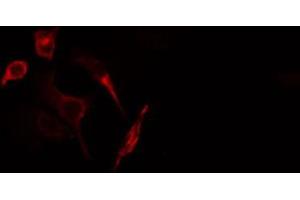 ABIN6266907 staining HuvEc cells by IF/ICC. (GUCY1B3 anticorps  (N-Term))