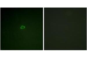 Immunofluorescence analysis of A549 cells, using 4E-BP1 (Ab-36) Antibody.