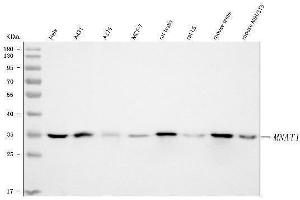 Western blot analysis of MNAT1 using anti-MNAT1 antibody (ABIN3043583).