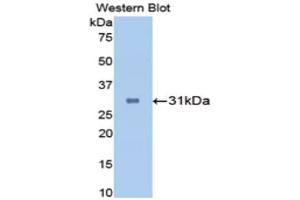 Western Blotting (WB) image for anti-Carbonic Anhydrase II (CA2) (AA 1-260) antibody (ABIN1173596)