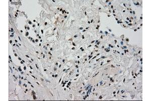 Image no. 10 for anti-Glucokinase (Hexokinase 4) (GCK) antibody (ABIN1498413) (GCK anticorps)