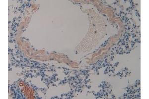 Detection of CLU in Mouse Lung Tissue using Polyclonal Antibody to Clusterin (CLU)