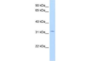 Western Blotting (WB) image for anti-Hydroxysteroid (17-Beta) Dehydrogenase 6 (HSD17B6) antibody (ABIN2462427) (HSD17B6 anticorps)