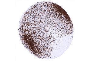 cerebellum cortex Stratum moleculare