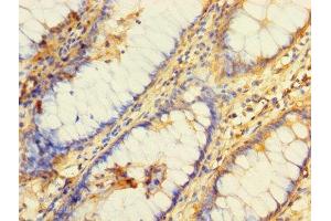 Immunohistochemistry of paraffin-embedded human colon tissue using ABIN7158679 at dilution of 1:100