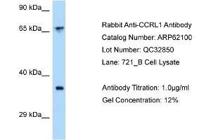Western Blotting (WB) image for anti-Chemokine (C-C Motif) Receptor-Like 1 (CCRL1) (C-Term) antibody (ABIN2789017) (CCRL1 anticorps  (C-Term))