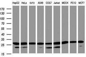 Image no. 3 for anti-Proteasome Subunit alpha 2 (PSMA2) (AA 50-234) antibody (ABIN1491567) (PSMA2 anticorps  (AA 50-234))