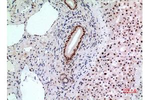 Immunohistochemistry (IHC) analysis of paraffin-embedded Human Liver, antibody was diluted at 1:100.