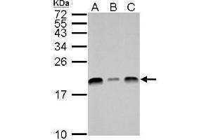WB Image UBE2L3 antibody detects UBE2L3 protein by Western blot analysis. (UBE2L3 anticorps  (C-Term))