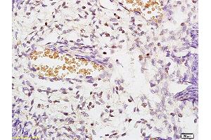 Formalin-fixed and paraffin embedded rat kidney labeled with Anti STK3/MST3 Polyclonal Antibody, Unconjugated (ABIN872978) at 1:200 followed by conjugation to the secondary antibody and DAB staining (STK3,STK4 (AA 101-200) anticorps)