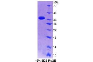 Image no. 1 for Protein Tyrosine Phosphatase F Interacting Protein 1 (PPFIA1) (AA 1-250) protein (T7 tag,His tag) (ABIN6239281)