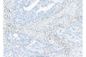 Immunohistochemistry (IHC) image for anti-V-type immunoglobulin domain-containing suppressor of T-cell activation (VISTA) (AA 250-311) antibody (ABIN7454034)