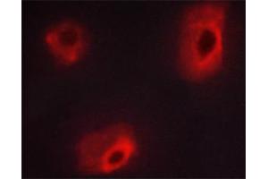 ABIN6267620 staining HeLa cells by ICC/IF.