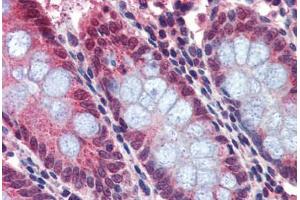 Human Colon: Formalin-Fixed, Paraffin-Embedded (FFPE)